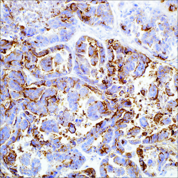 HBME-1 (HBME-1) Mouse Monoclonal Antibody