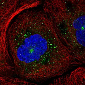 Anti-RAB11B antibody produced in rabbit Prestige Antibodies&#174; Powered by Atlas Antibodies, affinity isolated antibody