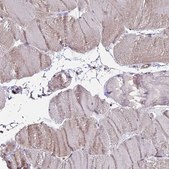 Anti-PPP4C antibody produced in rabbit Prestige Antibodies® Powered by Atlas Antibodies, affinity isolated antibody, buffered aqueous glycerol solution