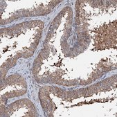 Anti-FLYWCH1 antibody produced in rabbit Prestige Antibodies® Powered by Atlas Antibodies, affinity isolated antibody, buffered aqueous glycerol solution