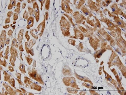 Monoclonal Anti-NDUFA8, (N-terminal) antibody produced in mouse clone 2E10, purified immunoglobulin, buffered aqueous solution