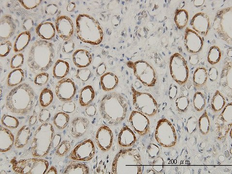 Monoclonal Anti-ACAA2 antibody produced in mouse clone 5C4, purified immunoglobulin, buffered aqueous solution