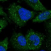 Anti-ARL14EP antibody produced in rabbit Prestige Antibodies® Powered by Atlas Antibodies, affinity isolated antibody, buffered aqueous glycerol solution
