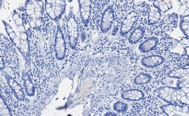 Anti-LLGL2 Antibody, clone 2H12 ZooMAb® Rabbit Monoclonal recombinant, expressed in HEK 293 cells