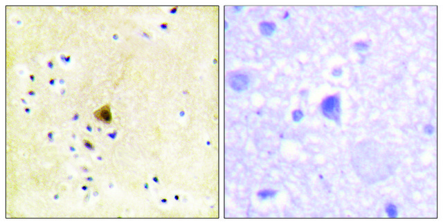 Anti-RYR2 antibody produced in rabbit affinity isolated antibody