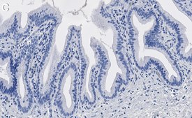 Anti-Parkin Antibody, clone 2J8 ZooMAb® Rabbit Monoclonal recombinant, expressed in HEK 293 cells