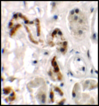 Anti-DBX1 antibody produced in rabbit affinity isolated antibody