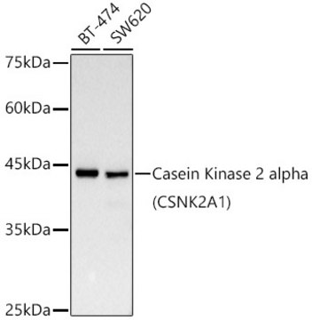 Anti-[KD Validated] Casein Kinase 2 alpha (CSNK2A1) Antibody, clone 2P3M7, Rabbit Monoclonal