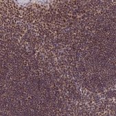 Anti-EXOSC3 antibody produced in rabbit Prestige Antibodies® Powered by Atlas Antibodies, affinity isolated antibody, buffered aqueous glycerol solution