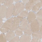 Anti-XIRP2 antibody produced in rabbit Prestige Antibodies® Powered by Atlas Antibodies, affinity isolated antibody, buffered aqueous glycerol solution