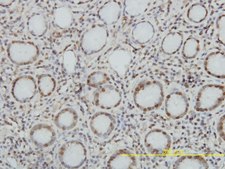 Monoclonal Anti-TOP1 antibody produced in mouse clone 1A1, purified immunoglobulin, buffered aqueous solution