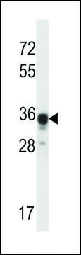 ANTI-ABHD4 (CENTER) antibody produced in rabbit affinity isolated antibody, buffered aqueous solution