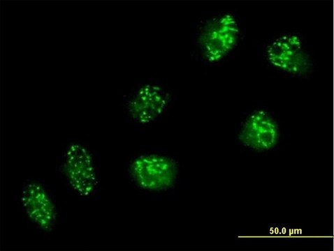 Anti-USP16 antibody produced in mouse purified immunoglobulin, buffered aqueous solution