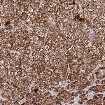 Anti-LIMS1 antibody produced in rabbit Prestige Antibodies&#174; Powered by Atlas Antibodies, affinity isolated antibody, buffered aqueous glycerol solution