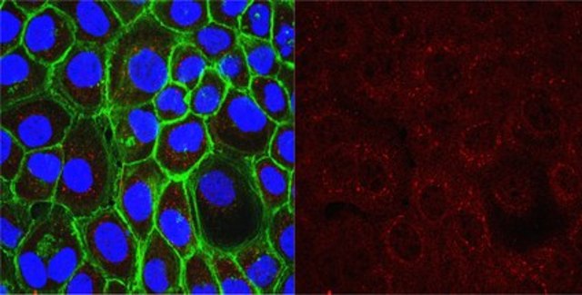 Anti-Oct-1 Antibody, clone YL15, Ascites Free clone YL15, from mouse