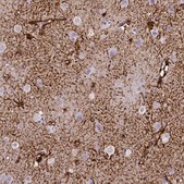 Monoclonal Anti-SLC22A2 antibody produced in mouse Prestige Antibodies&#174; Powered by Atlas Antibodies, clone CL0631, purified immunoglobulin, buffered aqueous glycerol solution