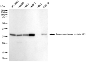 Anti Transmembrane Protein 192 Antibody, clone 24GB2305, Rabbit Monoclonal clone 24GB2305, recombinant rabbit monoclonal, expressed in HEK293 cells