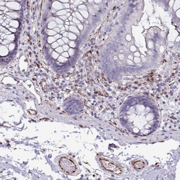 Anti-TMPRSS9 antibody produced in rabbit Prestige Antibodies&#174; Powered by Atlas Antibodies, affinity isolated antibody, buffered aqueous glycerol solution