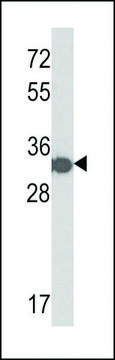 抗-HIS标签 兔抗 purified immunoglobulin, buffered aqueous solution