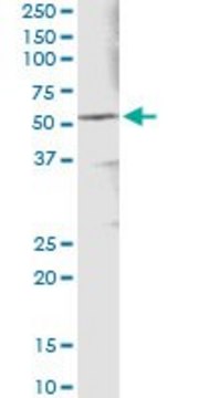 Monoclonal Anti-ALDH3A1 antibody produced in mouse clone 2G4, purified immunoglobulin, buffered aqueous solution