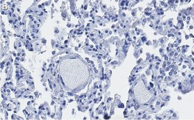 Anti-ACE2-extracellular Antibody, clone 1F21 ZooMAb® Rabbit Monoclonal recombinant, expressed in HEK 293 cells