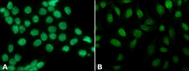 抗-组蛋白H3（N-末端） 兔抗 affinity isolated antibody, buffered aqueous solution