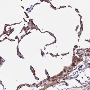 Anti-MEOX1 antibody produced in rabbit Prestige Antibodies&#174; Powered by Atlas Antibodies, affinity isolated antibody, buffered aqueous glycerol solution