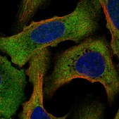 Anti-STRAP antibody produced in rabbit Prestige Antibodies® Powered by Atlas Antibodies, affinity isolated antibody