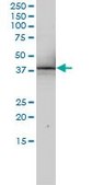 Monoclonal Anti-RNUT1 antibody produced in mouse clone 2B2-1B4, purified immunoglobulin, buffered aqueous solution