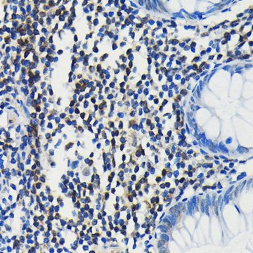 Anti-PIM1 antibody produced in rabbit