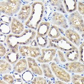 Anti- NOX4 antibody produced in rabbit