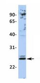 Anti-JAZF1 (AB1) antibody produced in rabbit affinity isolated antibody
