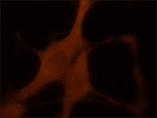 Monoclonal Anti-EXOC6 antibody produced in mouse ~1.0 mg/mL, clone 15S2G6, purified immunoglobulin