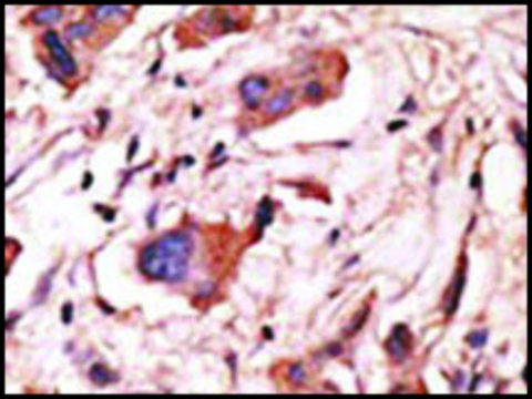 Anti-MAGED1 (center) antibody produced in rabbit IgG fraction of antiserum, buffered aqueous solution