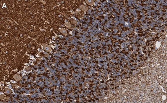 Anti-Synapsin-1 Antibody, clone 1G5 ZooMAb&#174; Rabbit Monoclonal recombinant, expressed in HEK 293 cells