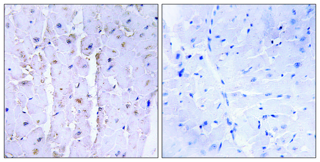 Anti-AKAP13 antibody produced in rabbit affinity isolated antibody