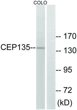 Anti-CEP135 antibody produced in rabbit affinity isolated antibody