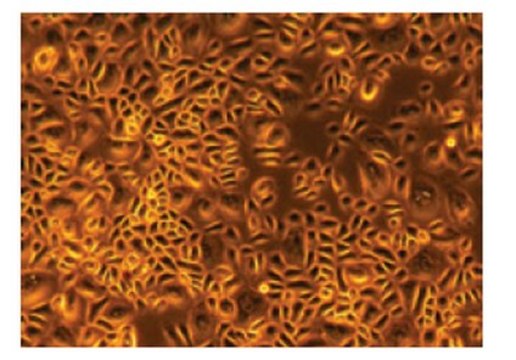 Human Epidermal Keratinocytes, Neonatal Human Neonatal Epidermal Keratinocytes provide an ideal serum-free culture model for the study of wound healing, toxicology, or biology when grown in our recommended medium.