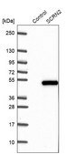 Anti-SCRN2 antibody produced in rabbit Prestige Antibodies® Powered by Atlas Antibodies, affinity isolated antibody, buffered aqueous glycerol solution, Ab1