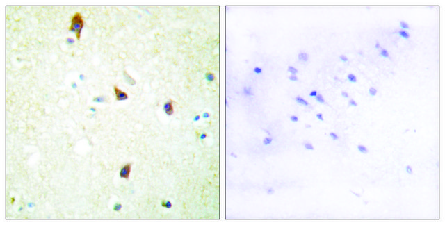 Anti-5-HT-2B antibody produced in rabbit affinity isolated antibody