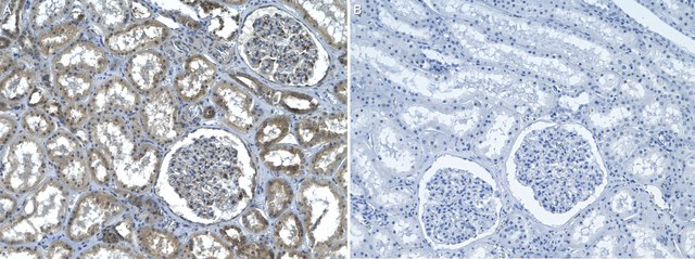 Anti-PKA C-&#945; Antibody, clone 2E17 ZooMAb&#174; Rabbit Monoclonal recombinant, expressed in HEK 293 cells