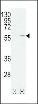 ANTI-VIMENTIN (S82) antibody produced in rabbit affinity isolated antibody, buffered aqueous solution