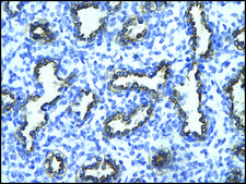 Anti-RFP2 (AB1) antibody produced in rabbit affinity isolated antibody