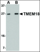 Anti-TMEM18 antibody produced in rabbit affinity isolated antibody, buffered aqueous solution