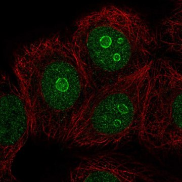 Anti-METTL22 antibody produced in rabbit Prestige Antibodies&#174; Powered by Atlas Antibodies, affinity isolated antibody