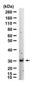Anti-TIMP3 Antibody, clone 1H8 ZooMAb® Rabbit Monoclonal recombinant, expressed in HEK 293 cells