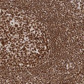 Anti-THRAP3 antibody produced in rabbit Prestige Antibodies® Powered by Atlas Antibodies, affinity isolated antibody, buffered aqueous glycerol solution