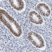 Anti-THRAP3 antibody produced in rabbit Prestige Antibodies® Powered by Atlas Antibodies, affinity isolated antibody, buffered aqueous glycerol solution