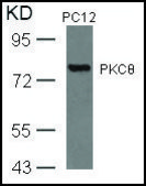 Anti-PRKCQ (Ab-676) antibody produced in rabbit affinity isolated antibody