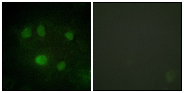 Anti-DDX5 antibody produced in rabbit affinity isolated antibody